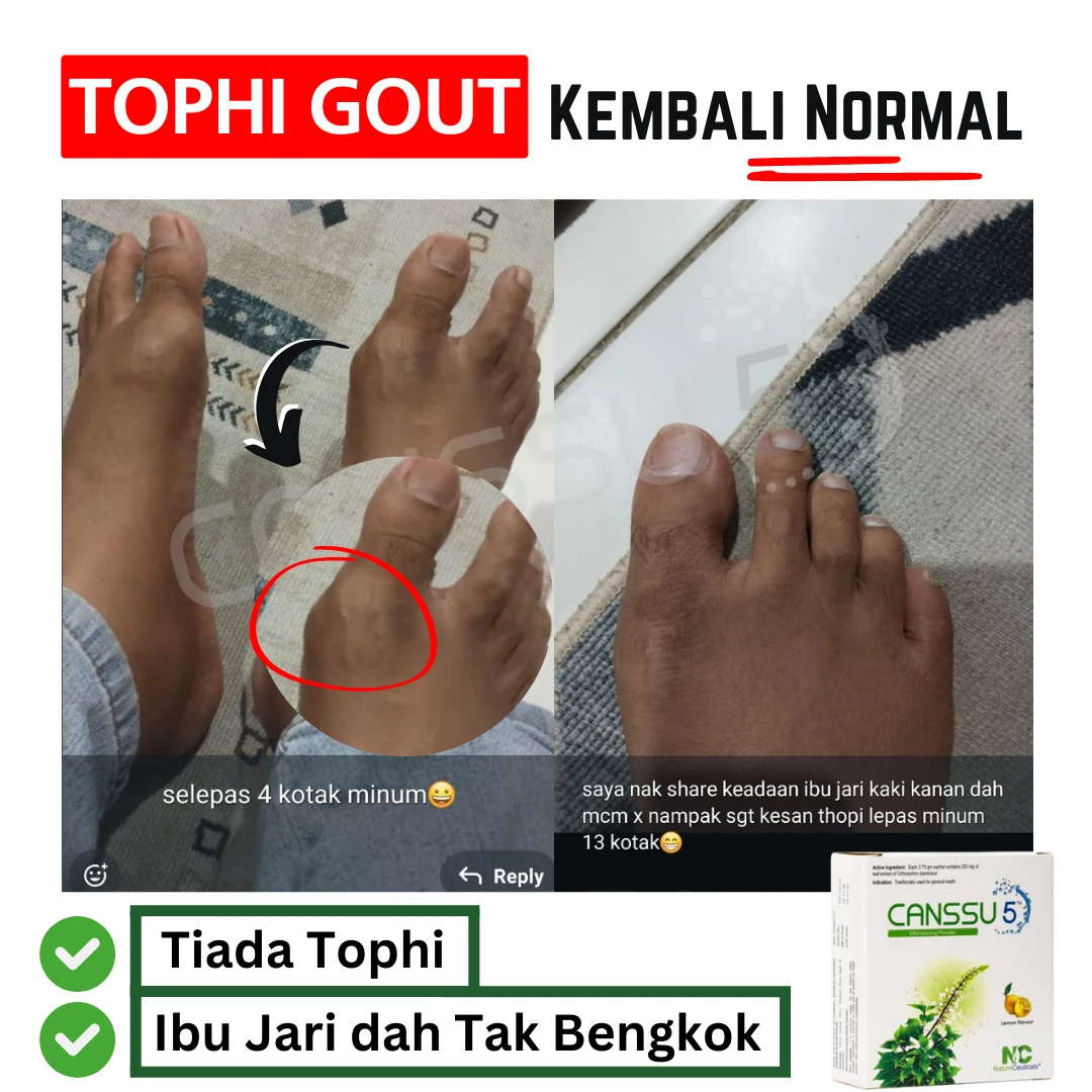 Gr-1.webp